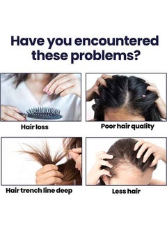 OUHOE Hair Growth Spray Strengthens Hair And Rejuvenates  - Image 2