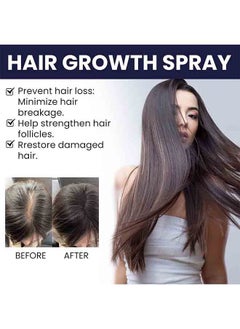 OUHOE Hair Growth Spray Strengthens Hair And Rejuvenates  - Image 4