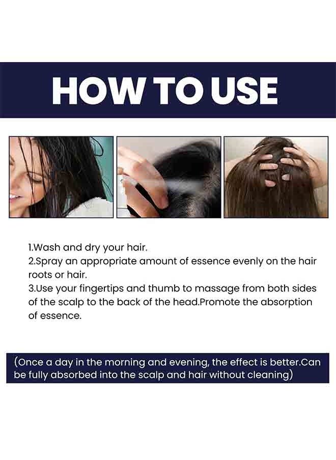 OUHOE - Hair Growth Spray Strengthens Hair And Rejuvenates - Image 1