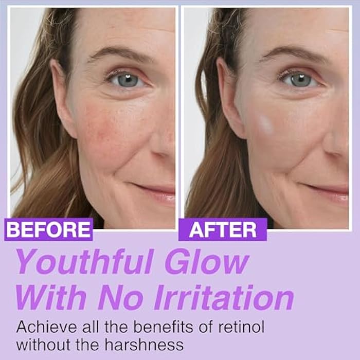 CELDYQUE Korean Bakuchiol Concentrate DIY Mix-in Serum 30,000 ppm - High Potency Retinol Alternative | Wrinkle Reduction Skin Firming & Smoothing - Anti-Aging Sensitive Skin Vegan & Cruelty-Free Non-GMO 1 oz - Image 4