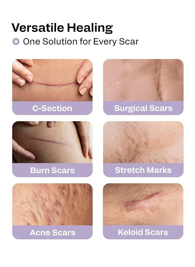 Silicone Scar Sheets for Surgical Scars - Seamless Medical Grade Silicone Scar Tape for C Section, Tummy Tuck Tape - Silicone Skin Patches After Surgery Must Haves - Image 5
