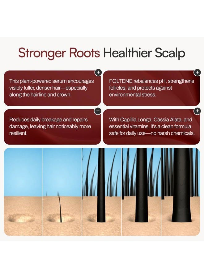 Foltene Pharma Hair and Sculp Treatment for Men - Image 5