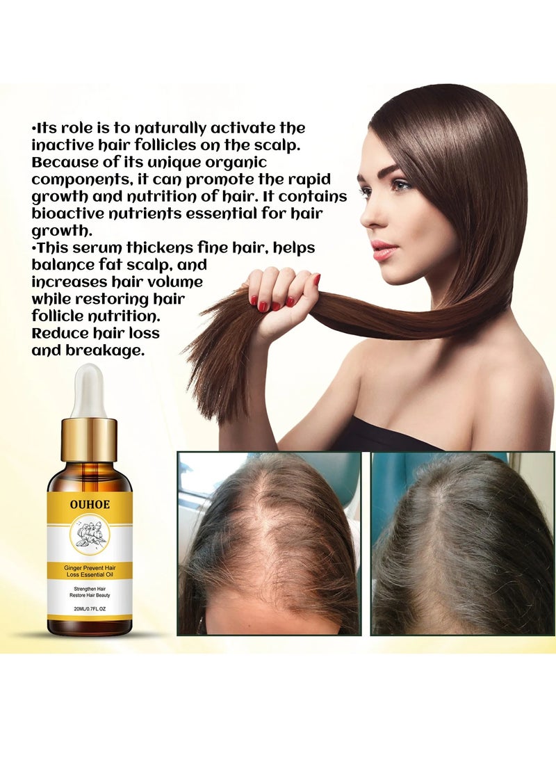 OUHOE - Ginger Hair Dense Essential Oil, Anti Hair Loss Germinal Ginger Hair Growth Oil, Moisturizing Scalp Treatment Hair Enhance Oil, Nourshing Hair Growth Essence For Hair Repair - Image 1