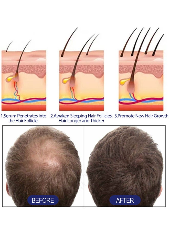 إيست مون رغوة معالجة لإعادة نمو الشعر للرجال - شعر رقيق 60 جرام، بصيلات الشعر، ينشط الشعر باستخدام الهباء الجوي الموضعي - Image 5
