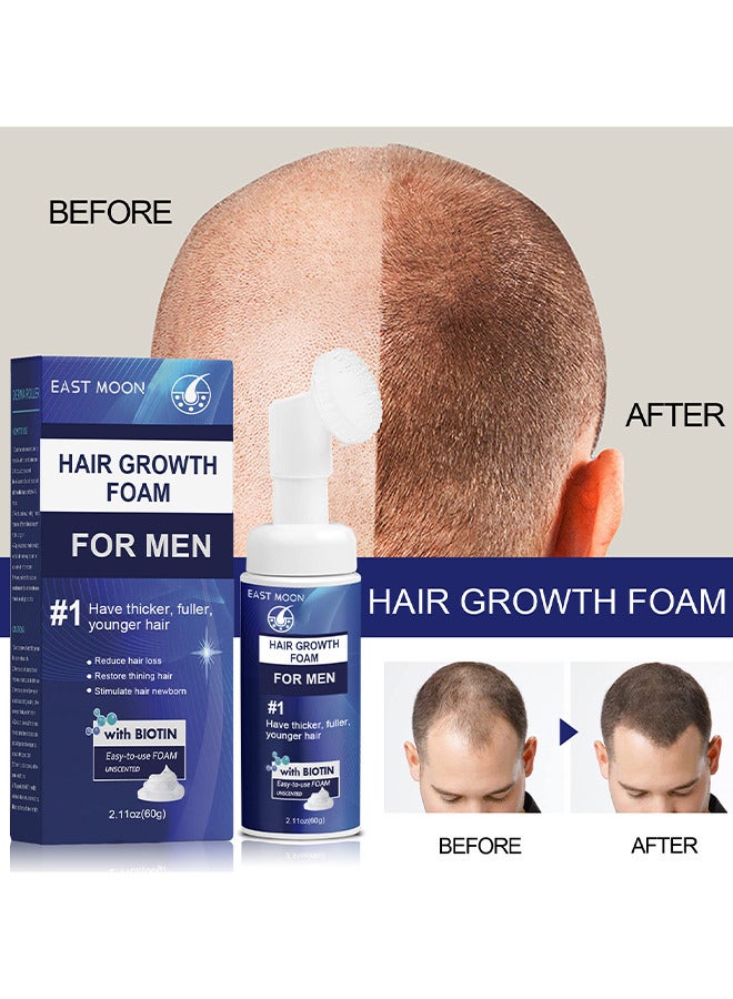إيست مون رغوة معالجة لإعادة نمو الشعر للرجال - شعر رقيق 60 جرام، بصيلات الشعر، ينشط الشعر باستخدام الهباء الجوي الموضعي - Image 2