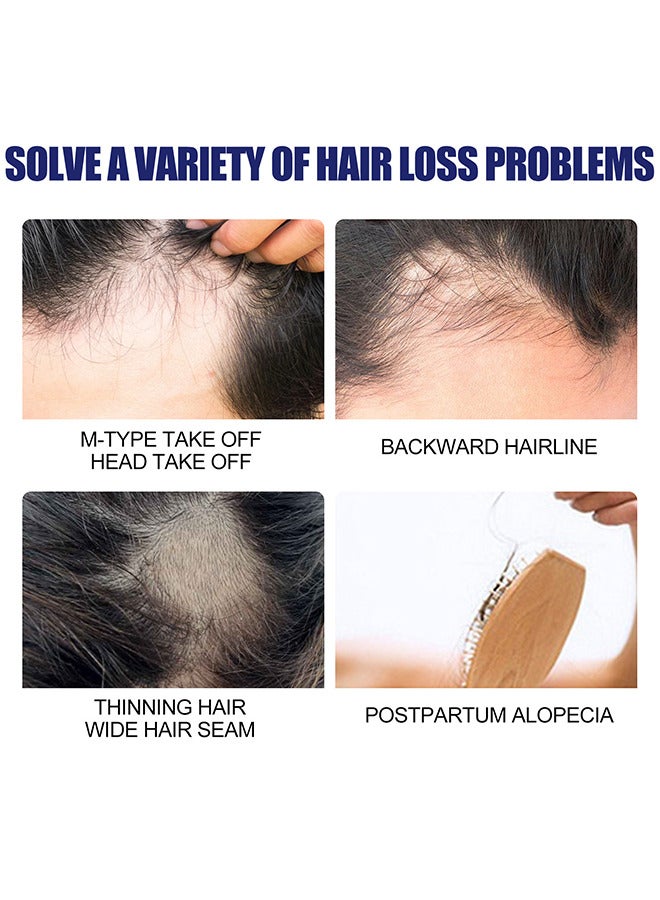 إيست مون رغوة معالجة لإعادة نمو الشعر للرجال - شعر رقيق 60 جرام، بصيلات الشعر، ينشط الشعر باستخدام الهباء الجوي الموضعي - Image 4