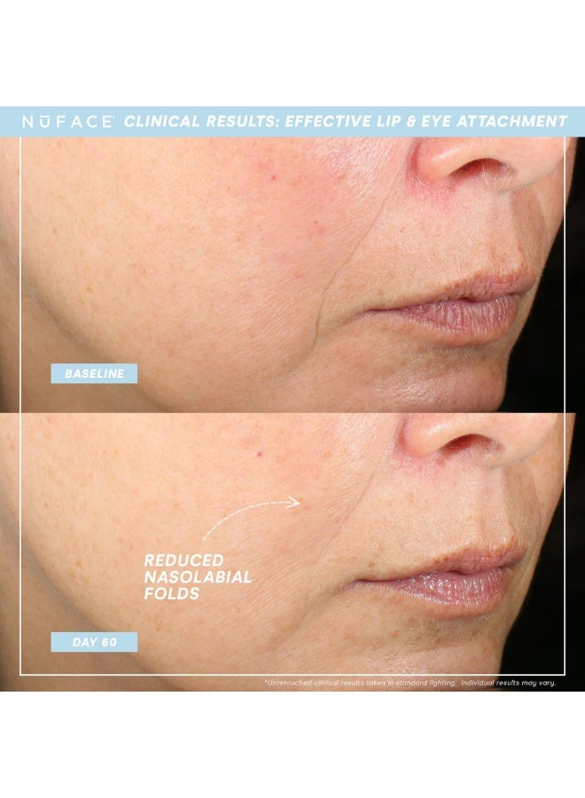 Nuface Trinity+ Lip And Eye Enhancer Attachment (NEW) - Image 2