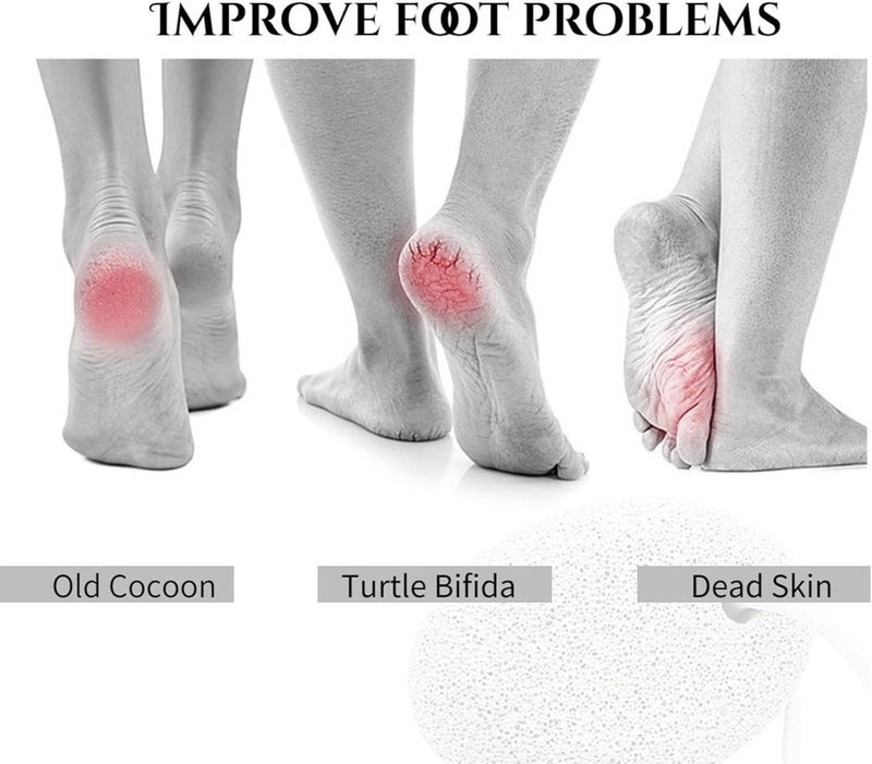 Pumice Foot Scrub - Heel Care Items,Hard Skin Foot Grinder - For Women Men Runners Athletes Dancers Home Travel Spa Salon Beauty Lovers Routine - Image 5