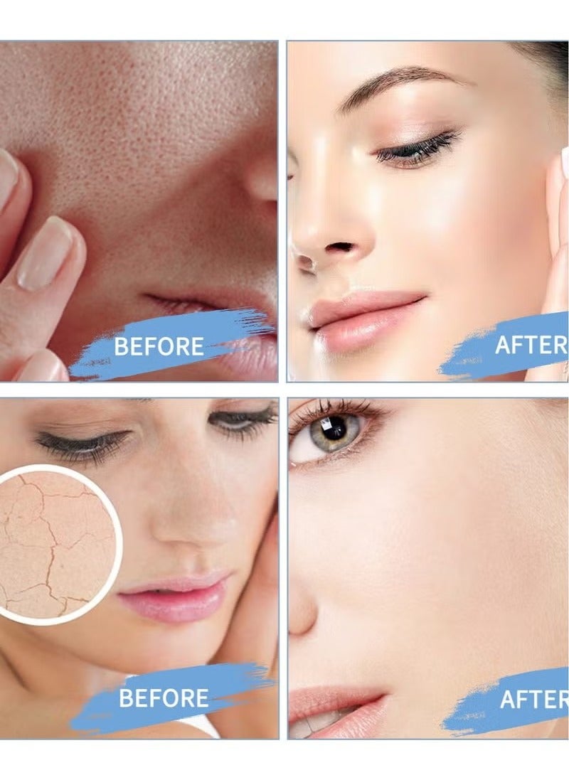 ديموت 147 مهدئا كريم ، كريم إصلاح الحاجز ، يوميا مرطب الوجه ، وتعزيز إصلاح البشرة الجافة والحساسة ، عيب مهدئا الرعاية ، وإصلاح حاجز الوجه ، ومناسبة لجميع أنواع البشرة - Image 4