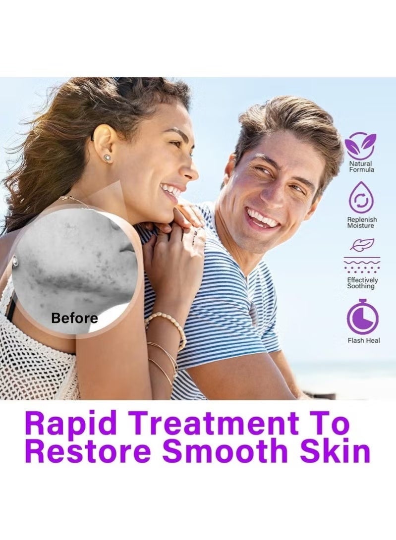 HTKCRX Azelaic Acid Serum, 12% Azelaic Acid, Hyaluronic Acid & Niacinamide, Redness Relief Face, Moisturizing and Balance Excess Sebum, Reducing Blemish & Rosacea Acne, for Sensitive Skin - Image 2