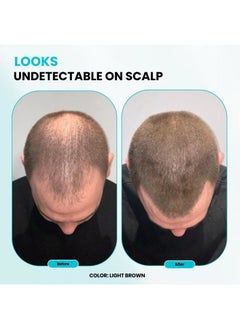 SureThik Hair Fibers, 15g (Dark Brown), Fills Thinning Hair for Visibly Fuller Look, Conceals Bald Spots, Natural Look, For Men & Women  - Image 5