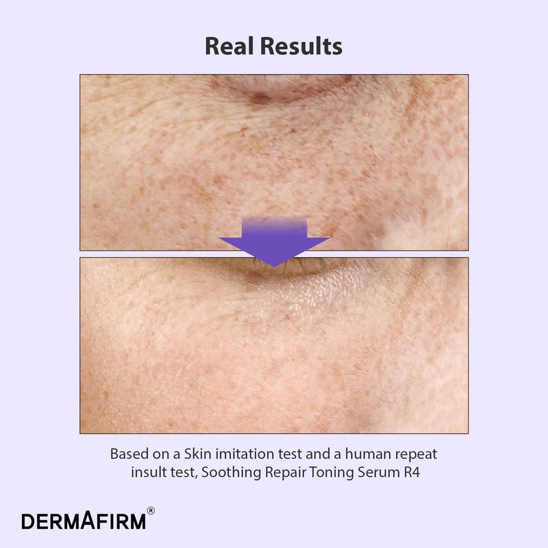 Dermafirm [Refill] DERMAFIRM Soothing Repair Toning Serum R4 - Korean Bakuchiol Retinol Niacinamide & Peptide Face Serum for Wrinkles - Calming, Moisturizing & Correcting- Paraben-Free, Cruelty-Free, 1.01 fl oz - Image 2