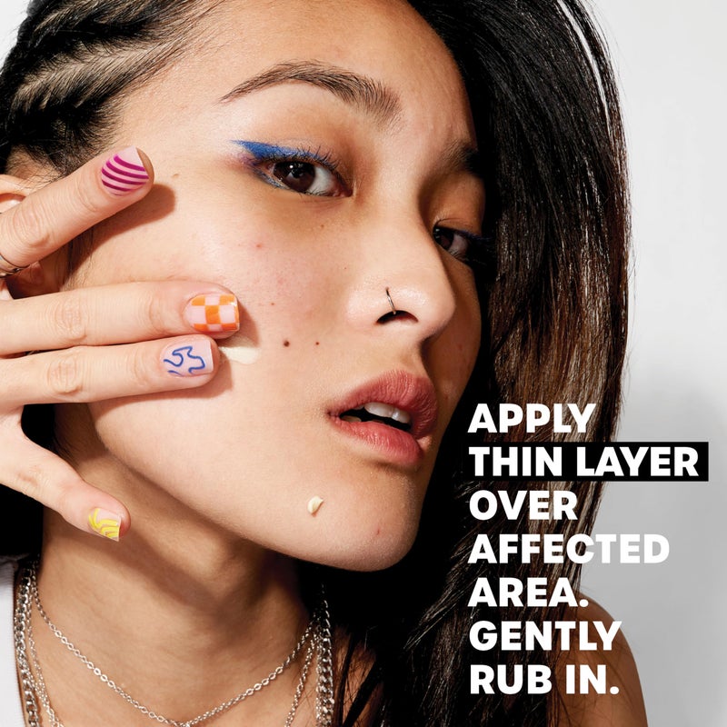 THAYERS Rapid Acne Treatment with 10% Sulfur, Sulfur Acne Treatment with Niacinamide and Glycolic Acid, Soothing and Non-Stripping Skin Care, 0.68 Fl Oz - Image 4