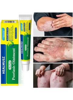 HEALMUSZ Psoriasis Ointment Herbal Psoriasis Cream Eczema Cream Body ...