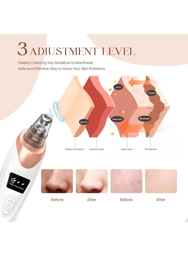 Blackhead Remover Pore Vacuum Kit -Blackhead Extractor Tool with 3 Adjustable Suction Levels, 5 Probes, USB Rechargeable, Suitable for Women and Men (with 4 sliver acne needles) - Image 3