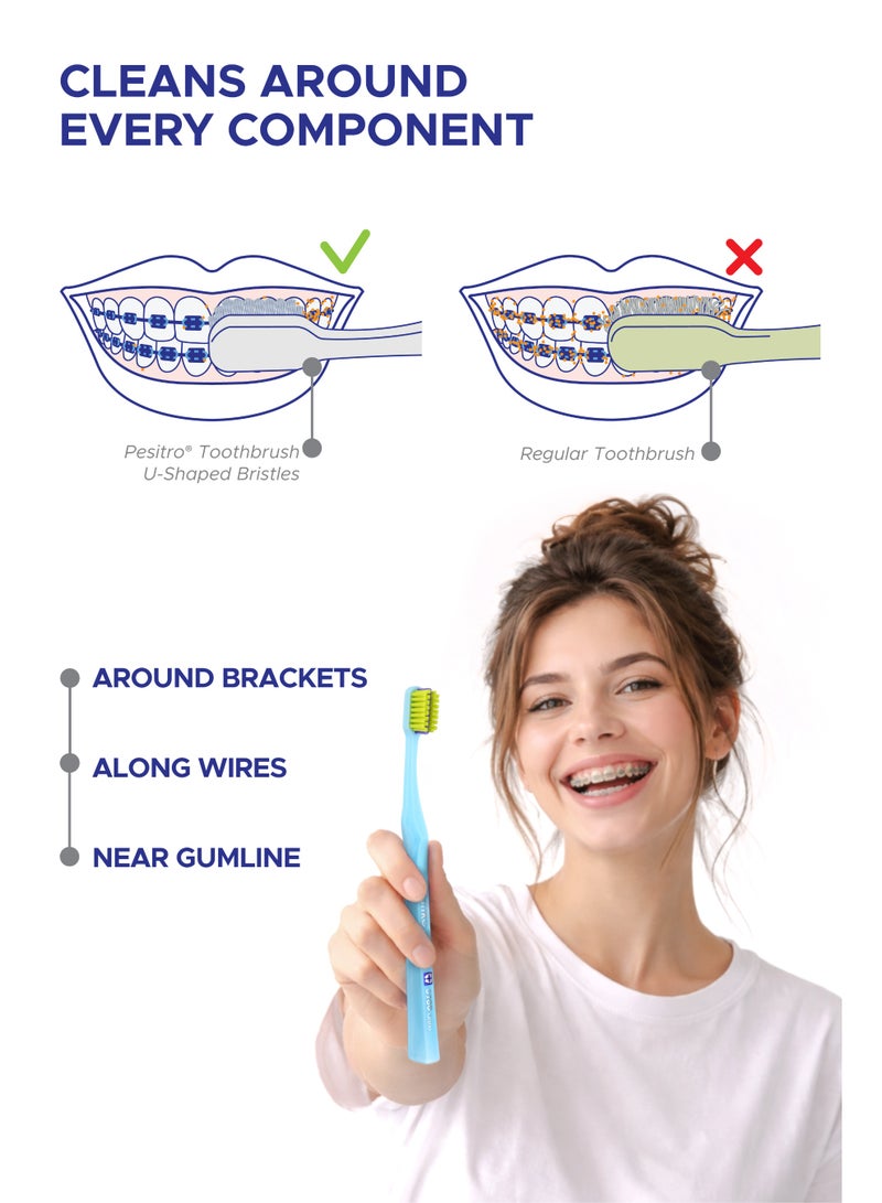 PESITRO UltraClean 3980 Super Soft Ortho Toothbrush – Orthodontic Brush with Soft Bristles (0.12mm), Angled Head for Braces & Sensitive Gums - Image 5