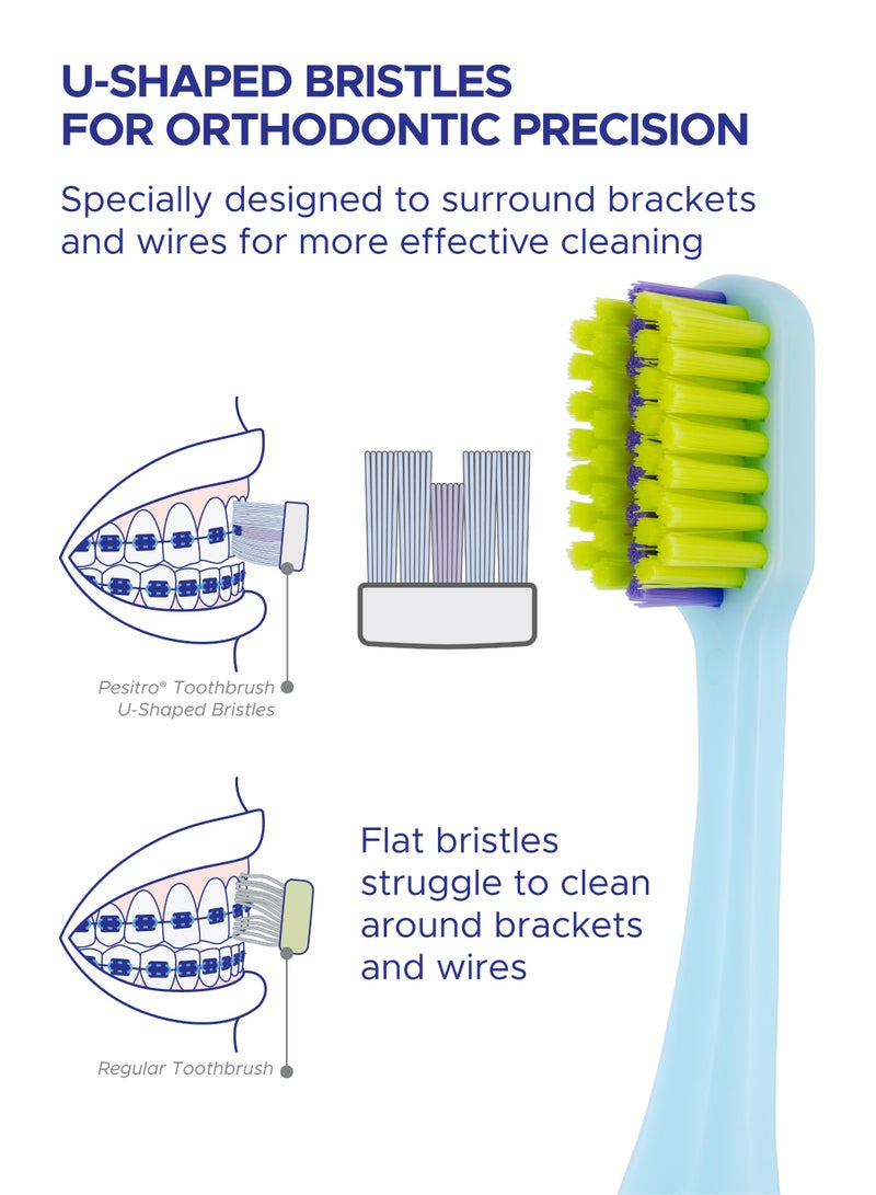 PESITRO UltraClean 3980 Super Soft Ortho Toothbrush – Orthodontic Brush with Soft Bristles (0.12mm), Angled Head for Braces & Sensitive Gums - Image 3