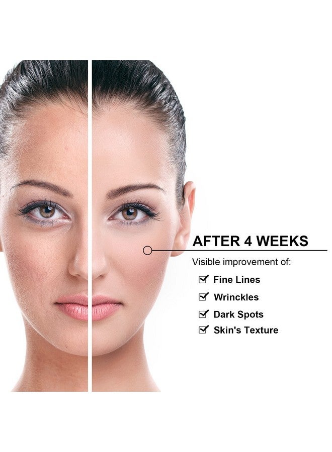 Elitzia Skin Care Carbon Peel Gel Skin Rejuvenation Black Face Doll Facial Skin Deep Cleaning Cream 300ML Elitzia ETBDF30 - Image 5