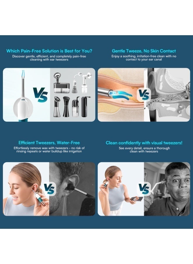 Bebird EarSight Ultra Visual Earwax Removal Camera Kit – 2K HD Medical-Grade Endoscope with 5G WiFi, Flexible Silicone Earpick, Tweezers, Sponge & Sticky Tips, ENT Diagnostic Tools, Safe Ear & Facial Cleaning for Adults, Kids & Family - Image 4