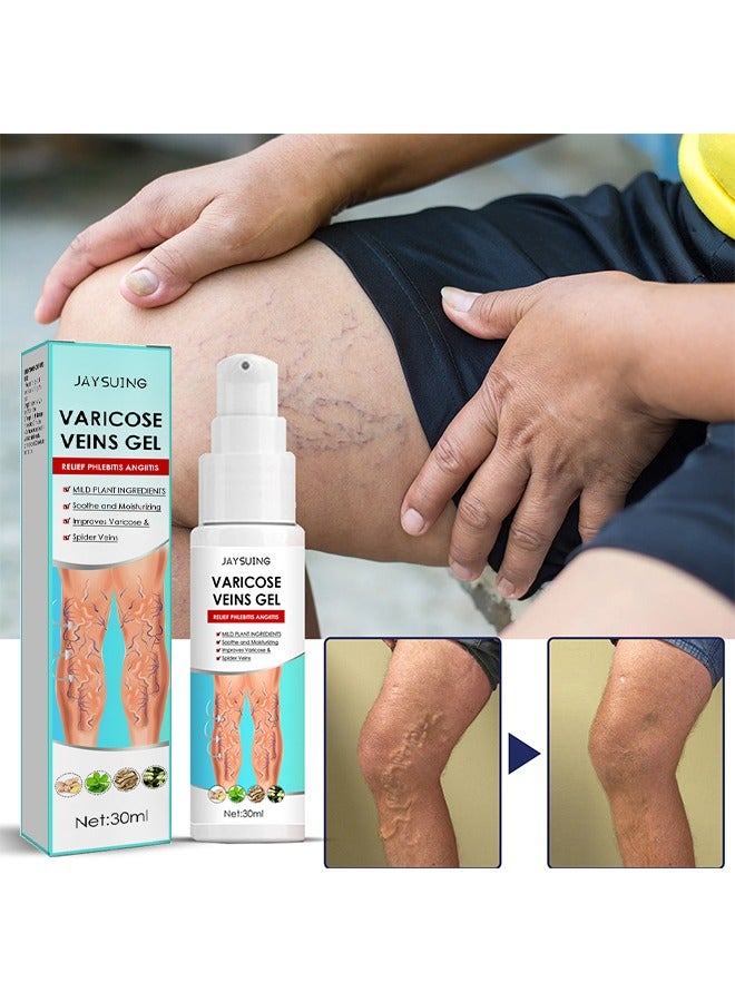 Jaysuing Varicose Veins Gel - Best Natural Varicose Veins Gel for Legs, Removes Veniselle Cream Para Varices, For Improve Blood Circulatio Quickly Soothing Swelling, 30ML  - Image 2