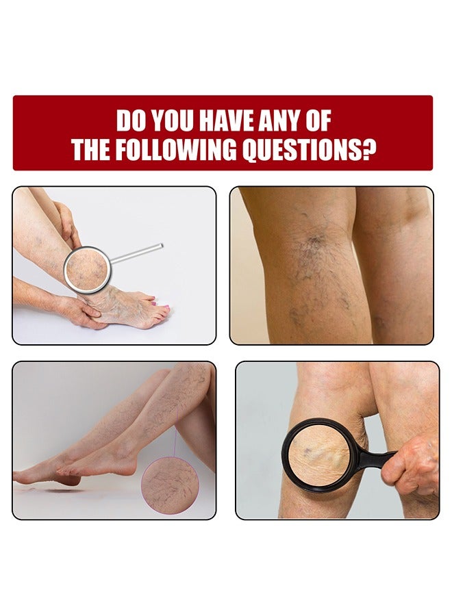 Jaysuing Varicose Veins Gel - Best Natural Varicose Veins Gel for Legs, Removes Veniselle Cream Para Varices, For Improve Blood Circulatio Quickly Soothing Swelling, 30ML  - Image 5