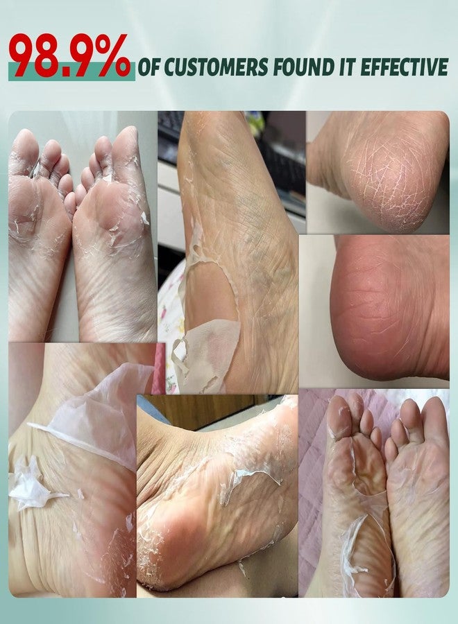 VGO 3 Pack Foot Peeling Mask, Natural Exfoliating Foot Mask, Dead Skin Callus Remover Repair Heels, Smooth Touch Feet, Hydrating Foot Care for Dry Cracked Feet - Image 3
