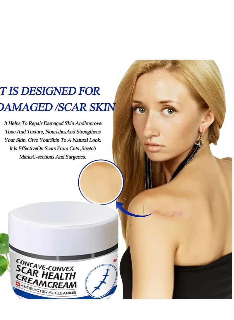 Generic - Scar Removal Cream Skin Repair Treatment  for Old and New 30g Advanced for Stretch Marks Acne C-Section Burns and Other - Image 1