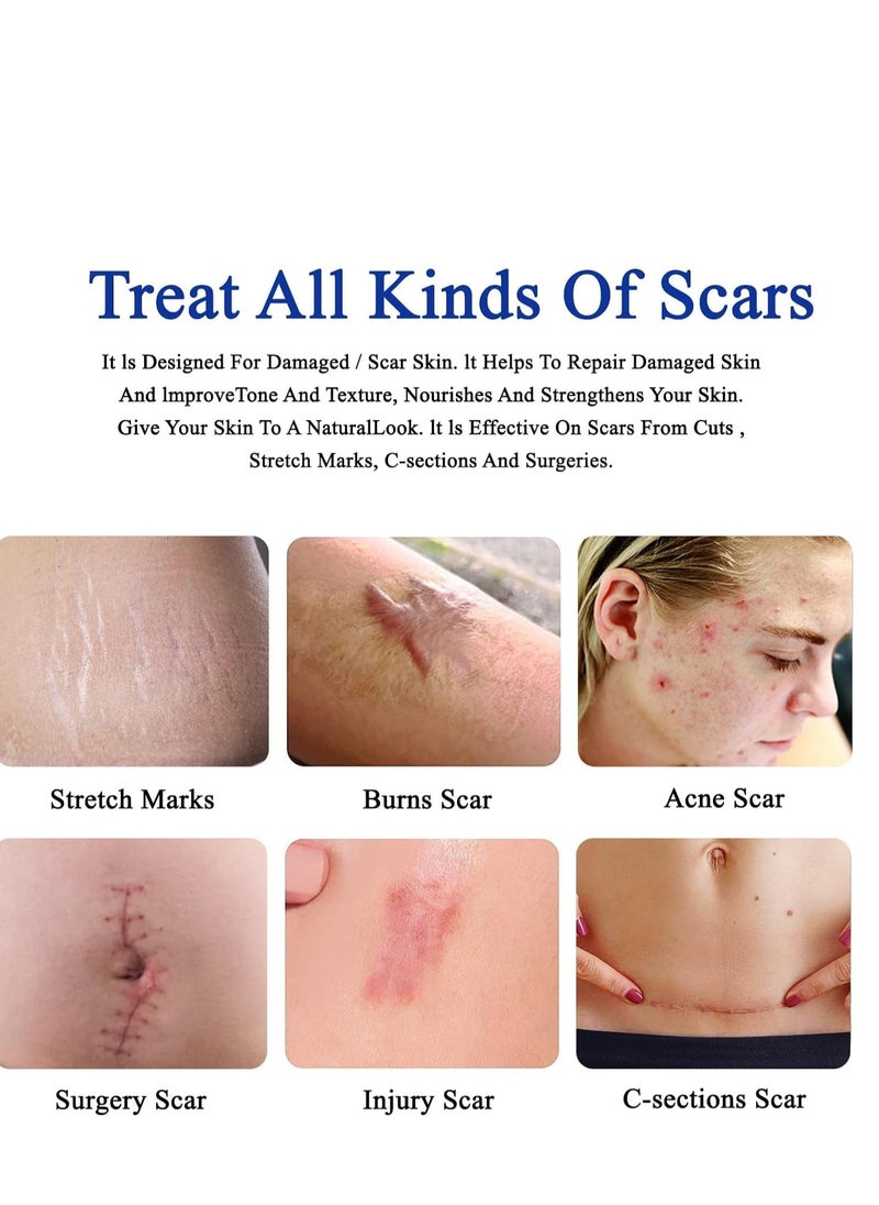 Generic - Scar Removal Cream Skin Repair Treatment  for Old and New 30g Advanced for Stretch Marks Acne C-Section Burns and Other - Image 1