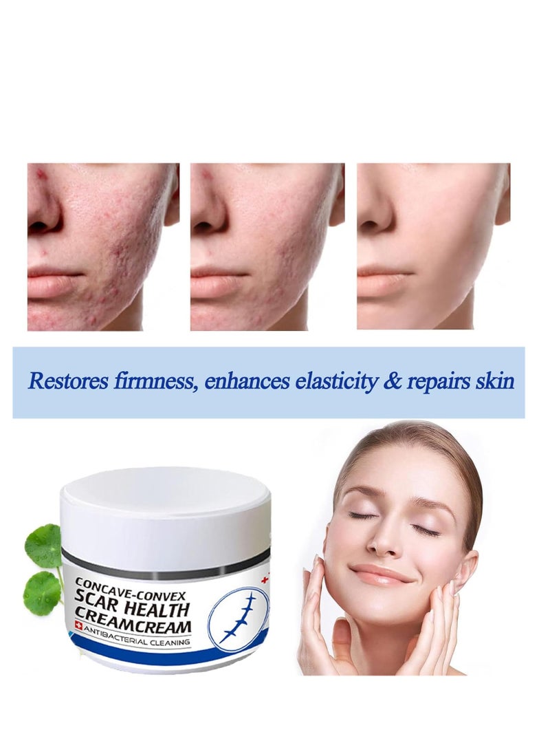 Generic - Scar Removal Cream Skin Repair Treatment  for Old and New 30g Advanced for Stretch Marks Acne C-Section Burns and Other - Image 1
