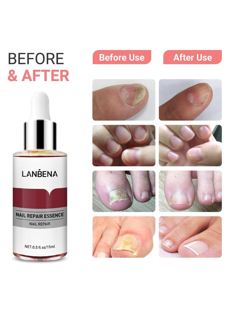 لان بينا خلاصة إصلاح الأظافر 15 مل - Image 4