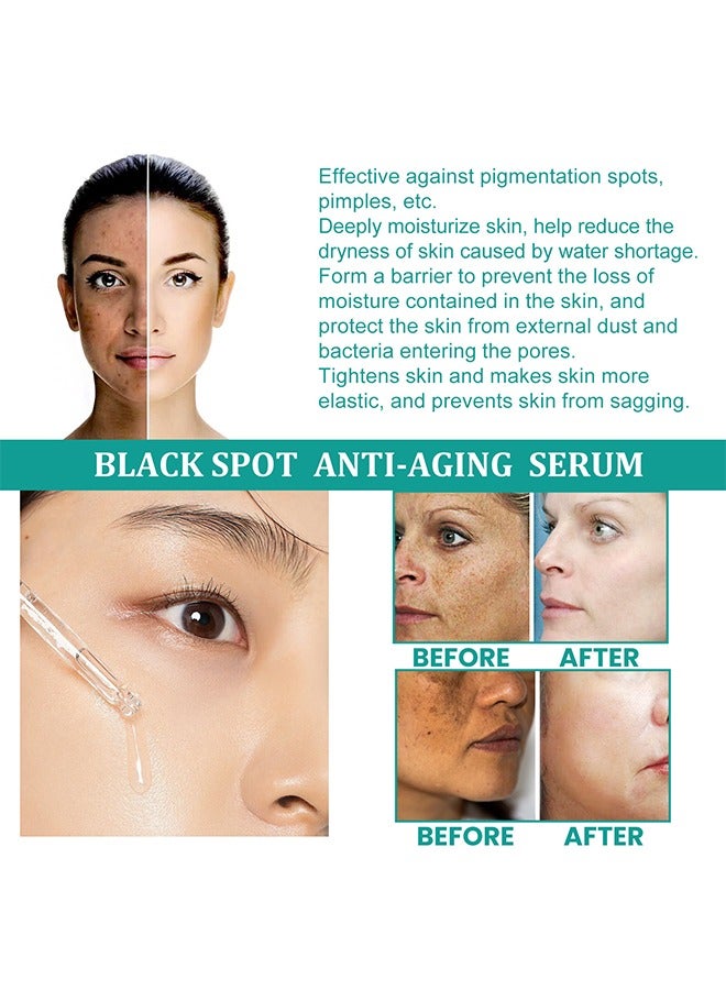 إيلهو مصل مضاد للشيخوخة من البقع السوداء ، مصل تفتيح البقع للوجه والجسم - مصل تفتيح وتفتيح الوجه ، تفتيح البشرة وتحسين حاجز البشرة (30 مل) - Image 3