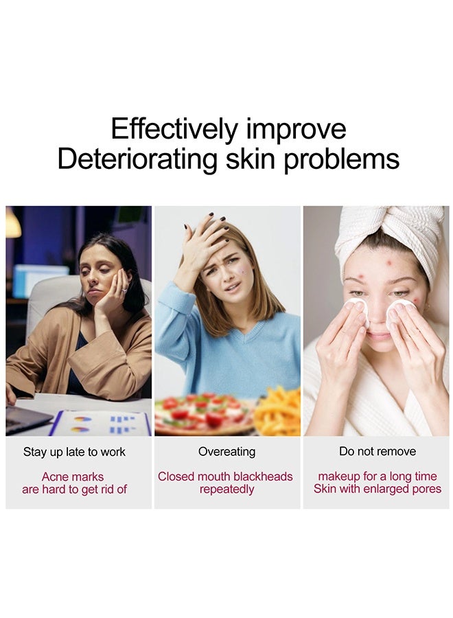 Sefudun Aha 30% Alpha Hydroxy Acid Serum & Salicylic Acid,Acne And Blackheads | Helps With Open Pores, Breakouts And Bumpy Texture - Image 4