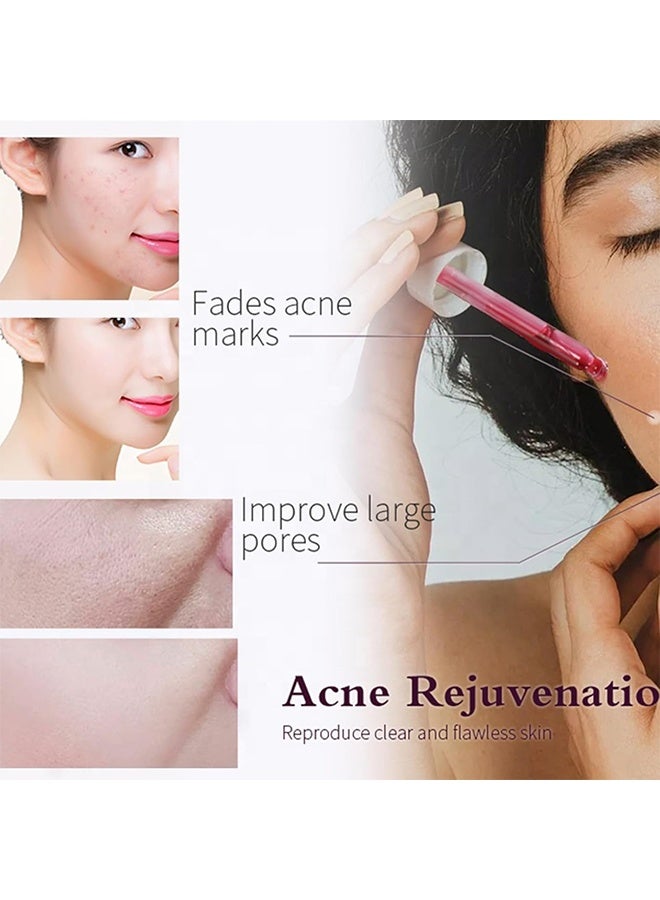 Sefudun Aha 30% Alpha Hydroxy Acid Serum & Salicylic Acid,Acne And Blackheads | Helps With Open Pores, Breakouts And Bumpy Texture - Image 5