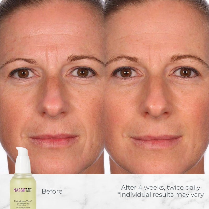 NassifMD Hydro-Screen Hydration Serum | Surgeon-Created Hyaluronic Acid, Ceramides & Retinol Formula for Plumping, Firming & Reducing Fine Lines - Image 3