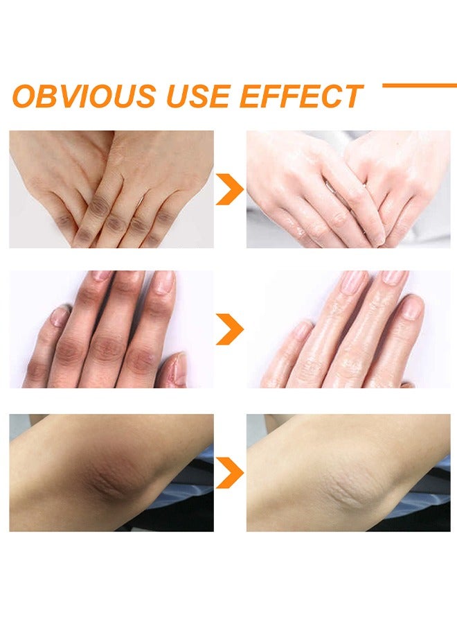 EELHOE Body Whitening Peeling Lotion - Dead Skin Exfoliating Skin Moisturizing Hydrating Butter Peeling off Wax Remove Dead Skin and Calluses Body Whitening Skin Lotion for Men & Women 100ml - Image 4