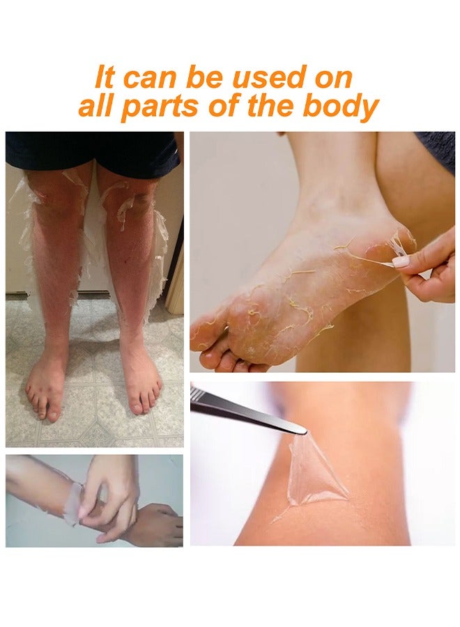 EELHOE Body Whitening Peeling Lotion - Dead Skin Exfoliating Skin Moisturizing Hydrating Butter Peeling off Wax Remove Dead Skin and Calluses Body Whitening Skin Lotion for Men & Women 100ml - Image 3