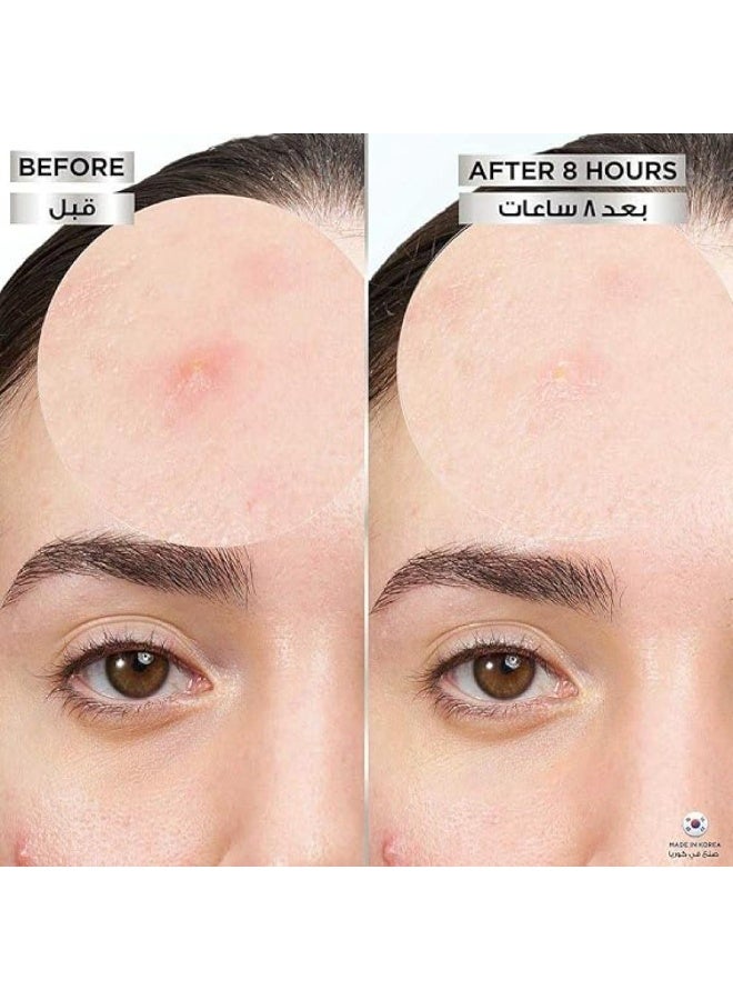 Cure aid Hydrocolloid spots 24pcs - Image 4