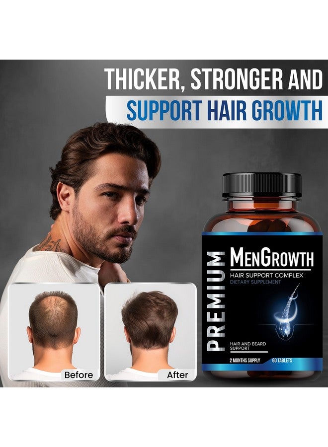 NutraPro Mens Hair Growth-Hair Vitamins For Men. Anti Hair Loss Supplement, Regrow Hair & Beard Growth Pills With DHT Blocker For Thinning Hair & Hair Thickening With Biotin & Saw Palmetto.Thicker Fuller Hair - Image 2