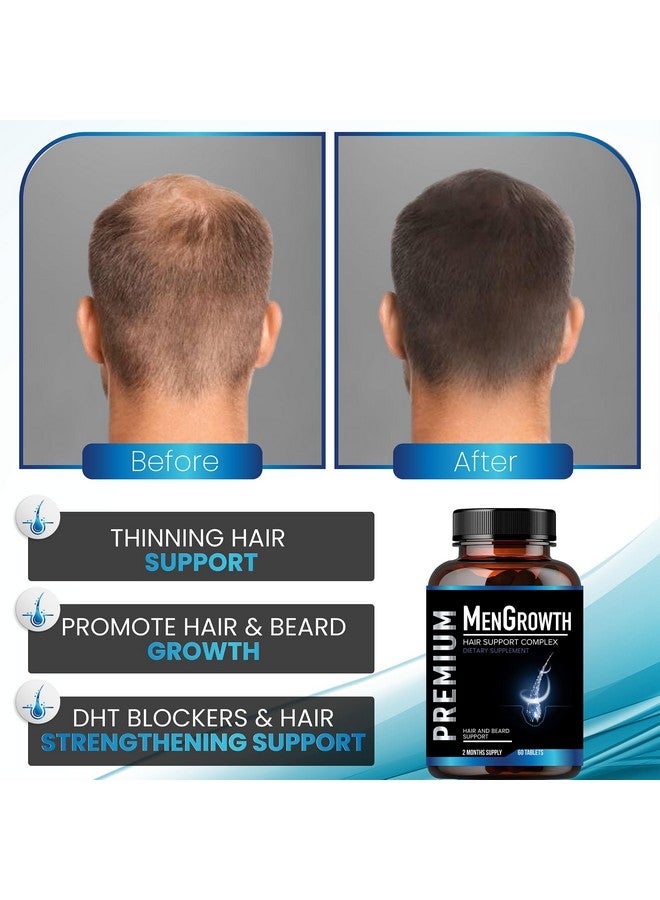 NutraPro Mens Hair Growth-Hair Vitamins For Men. Anti Hair Loss Supplement, Regrow Hair & Beard Growth Pills With DHT Blocker For Thinning Hair & Hair Thickening With Biotin & Saw Palmetto.Thicker Fuller Hair - Image 4