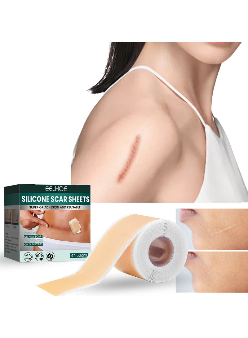 EELHOE 4cm*1.5m Fade Scar Sticker Efficient Beauty Scars Removal Silicone Gel Skin Tone Self-adhesive Acne Burn Repair Patch - Image 1
