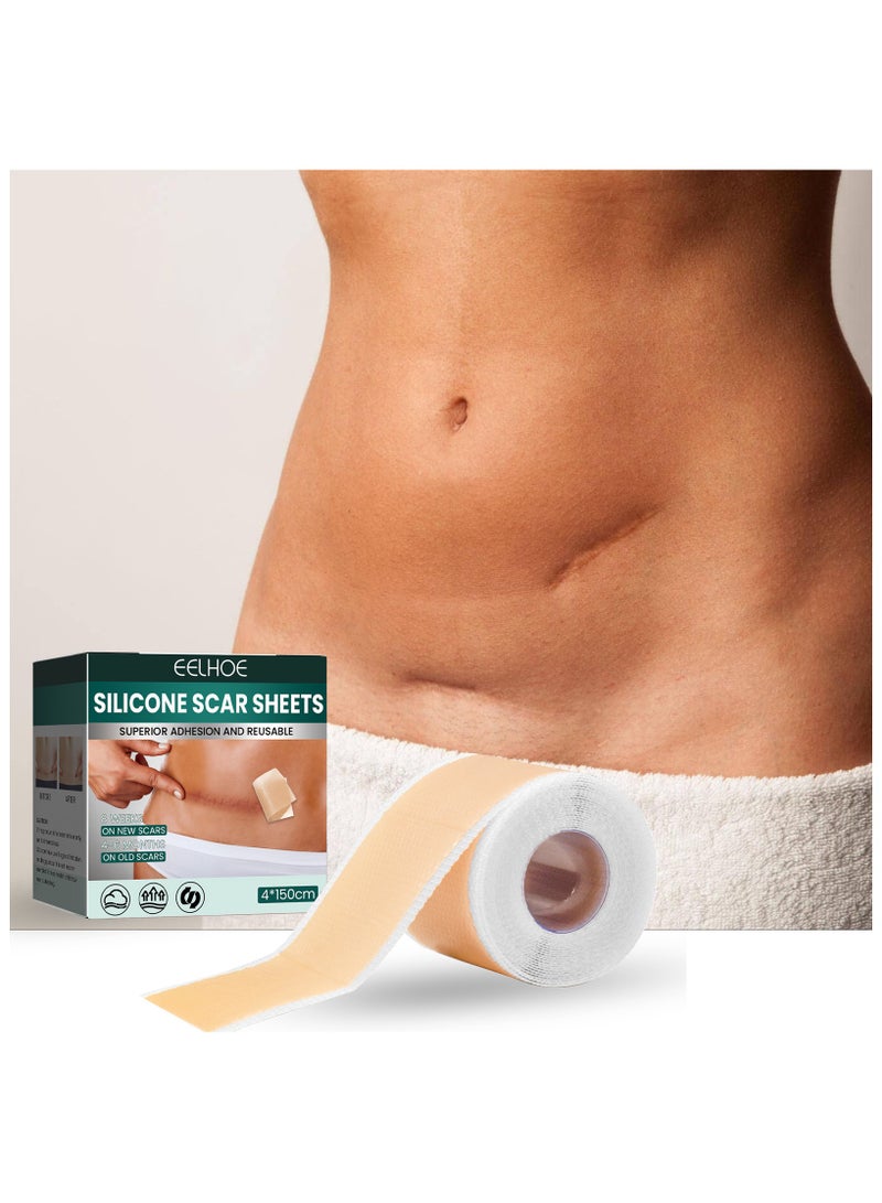 EELHOE 4cm*1.5m Fade Scar Sticker Efficient Beauty Scars Removal Silicone Gel Skin Tone Self-adhesive Acne Burn Repair Patch - Image 3