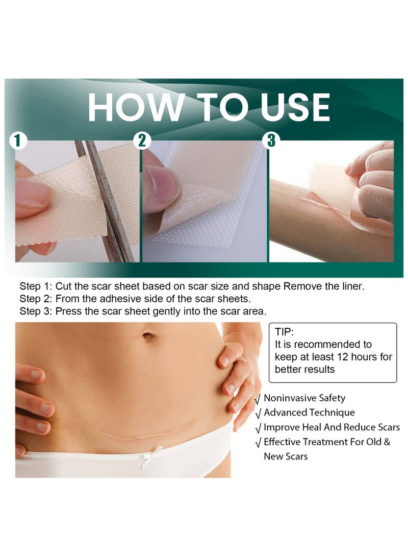 EELHOE 4cm*1.5m Fade Scar Sticker Efficient Beauty Scars Removal Silicone Gel Skin Tone Self-adhesive Acne Burn Repair Patch - Image 4