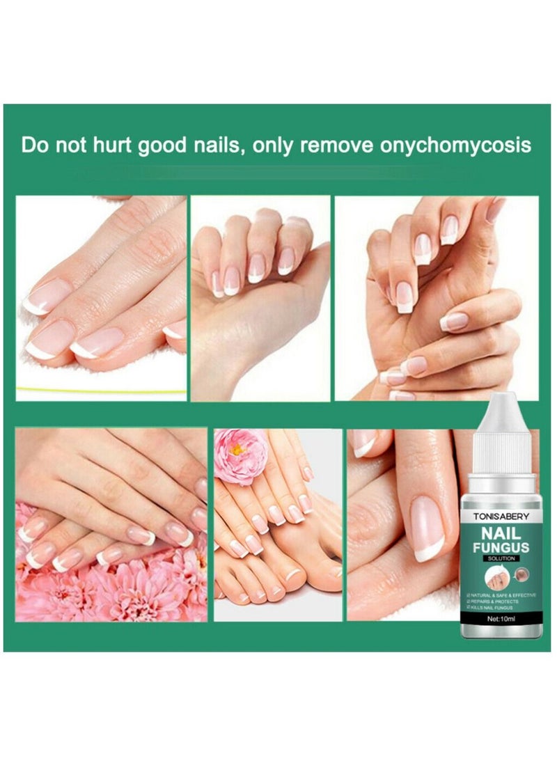 TONISABERY - Fungal Nail Repair Essence Serum Care Treatment Foot Nail Fungus Removal Serum - Image 1
