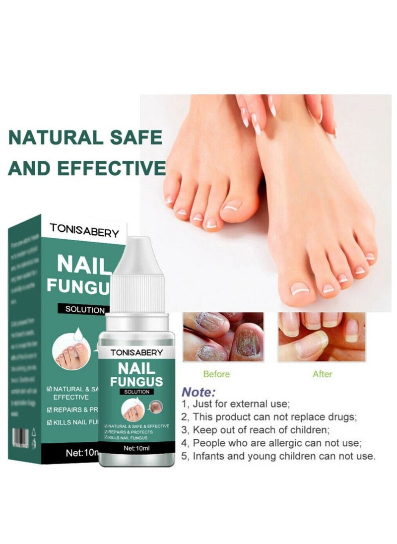 TONISABERY - Fungal Nail Repair Essence Serum Care Treatment Foot Nail Fungus Removal Serum - Image 1