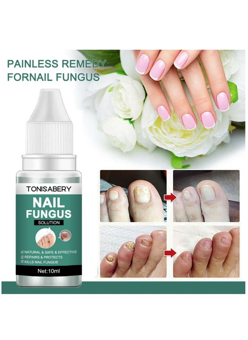 TONISABERY - Fungal Nail Repair Essence Serum Care Treatment Foot Nail Fungus Removal Serum - Image 1