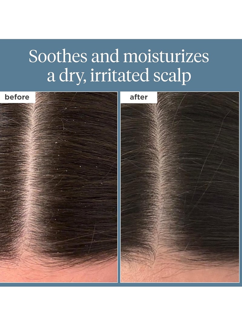 Briogeo - Briogeo Scalp Revival Rosemary Pre-Wash Oil, Hair and Scalp, Dry Scalp Treatment for Stronger and Longer Hair, Soothe Dry Scalp, Lipids and Vitamins, Deep Moisture, Vegan, Cruelty-Free, 3.4 fl oz - Image 1