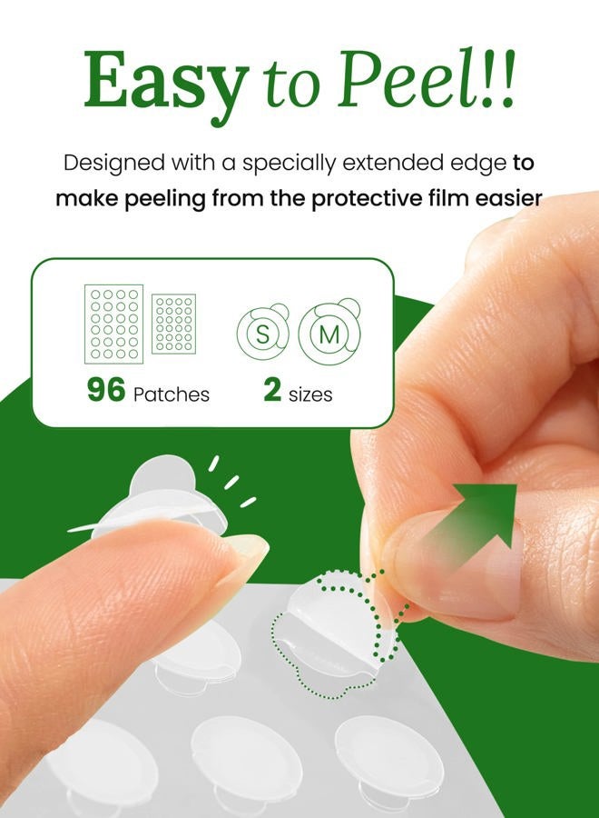 Troubless Invisible Pimple Patch Classic, 96 Patches (2 Sizes) – Ultra Thin Hydrocolloid Spot Treatment for Daytime Use, Easy Peel, Fast Healing, Absorbs Oil & Impurities, For Acne-Prone Skin - Image 4