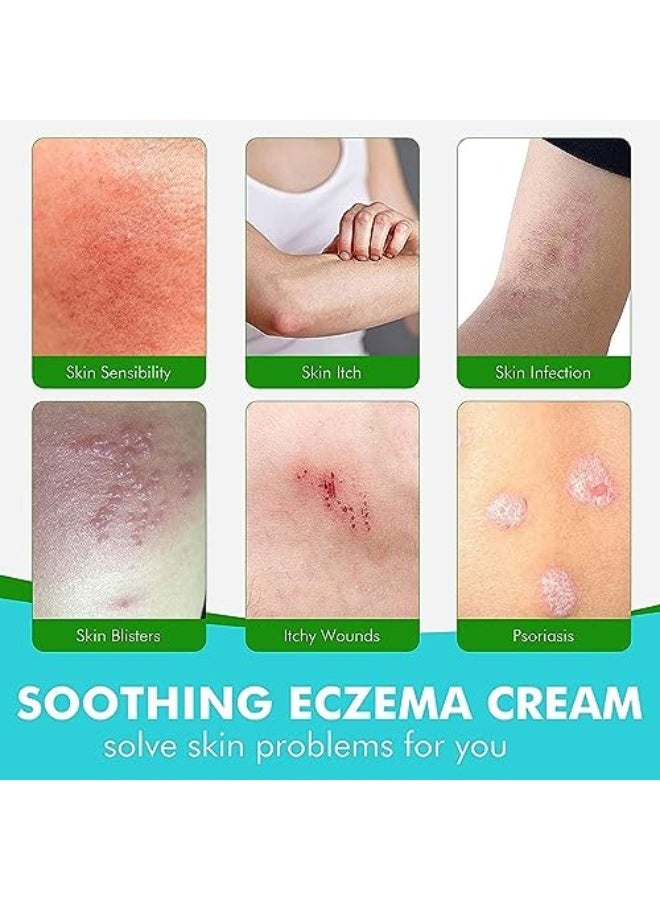 سوميفون 1 قطعة كريم مضاد للبكتيريا للصدفاف والإكزيما كريم مضاد للفطريات ، يساعد الإكزيما ، كريم مضاد للحكة الدودة الحلقية مع مكونات عشبية أكثر لطفا وأمان بسرعة يخفف من الحكة للوجه والجسم - Image 4