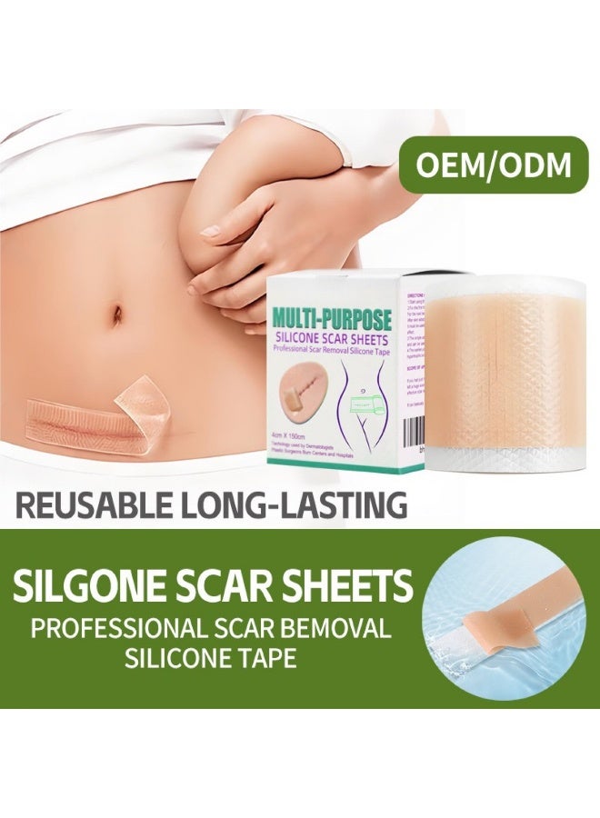 Generic Silicone Scar Patch, Fade Scar Sticker, Efficient Beauty Scars Removal Cesarean Section Burn Scars Left Behind Gel Painless Tape Roll (4cm * 1.5m)  - Image 3