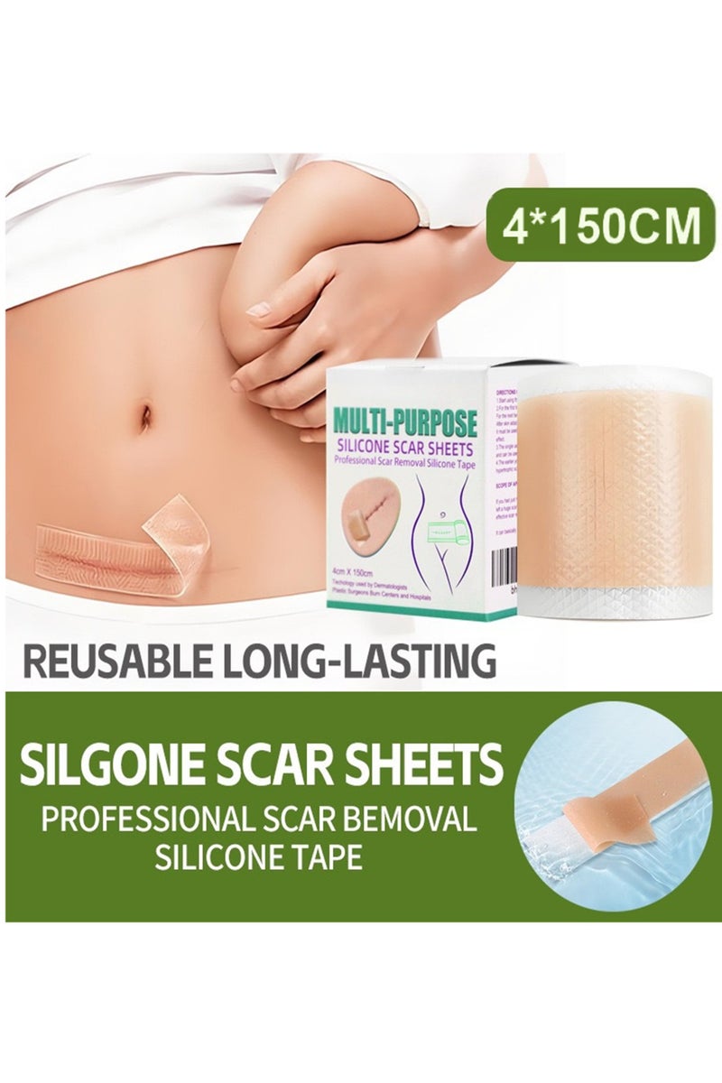 Silicone Scar Patch, Fade Scar Sticker, Efficient Beauty Scars Removal Cesarean Section Burn Scars Left Behind Gel Painless Tape Roll (4cm * 1.5m) - Image 1